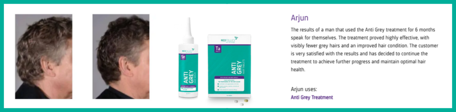 Neofollics - Anti Grey